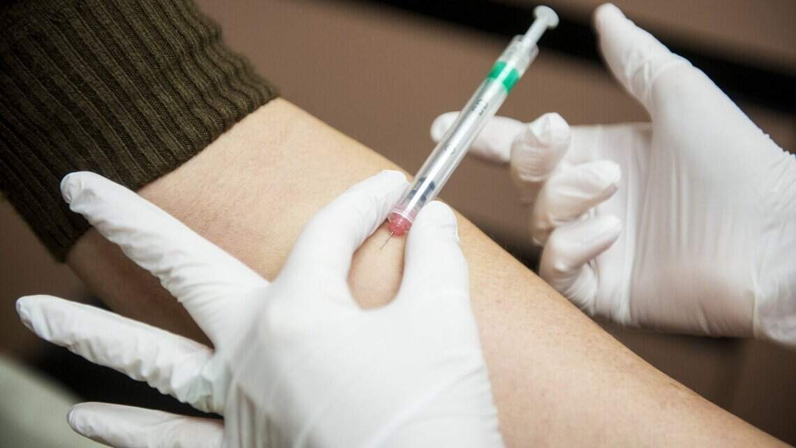 COVID pandemic demonstrates why U.S. should fund more tuberculosis prevention work