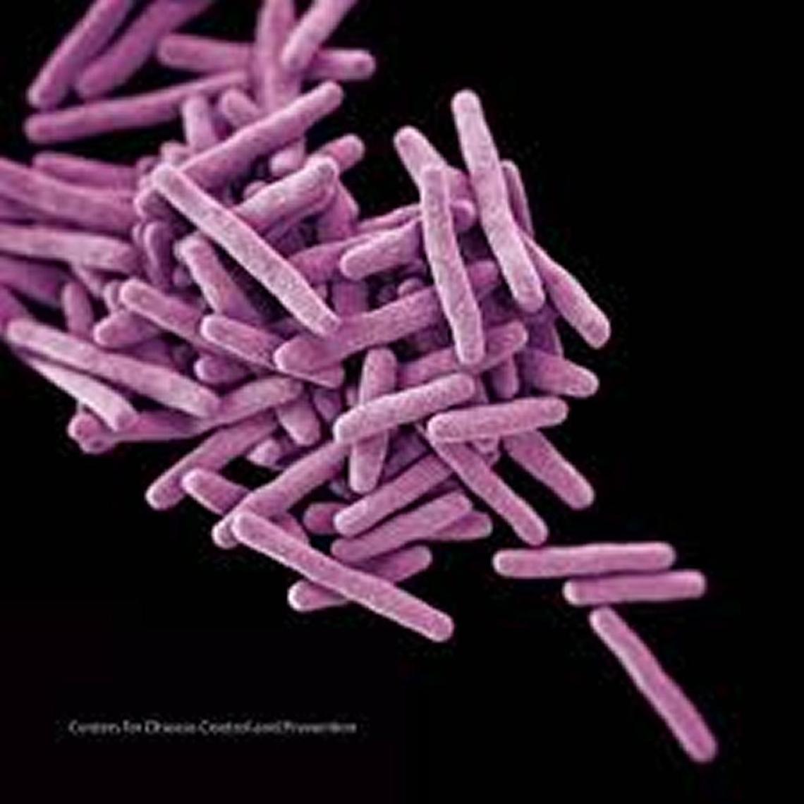 The tuberculosis bacteria is spread through the air.