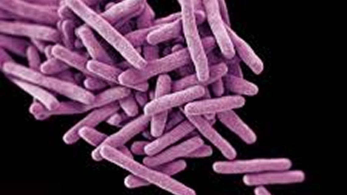 The tuberculosis bacteria is spread through the air.