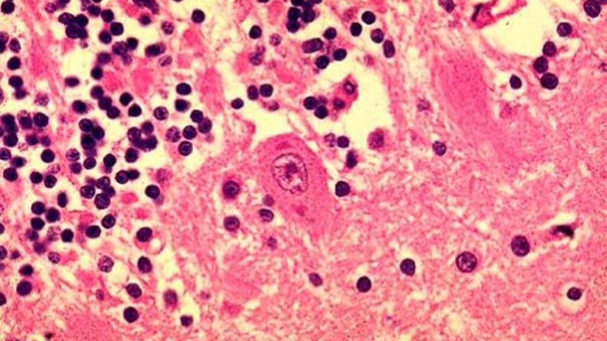 This is a view of the rabies virus under a microscope.