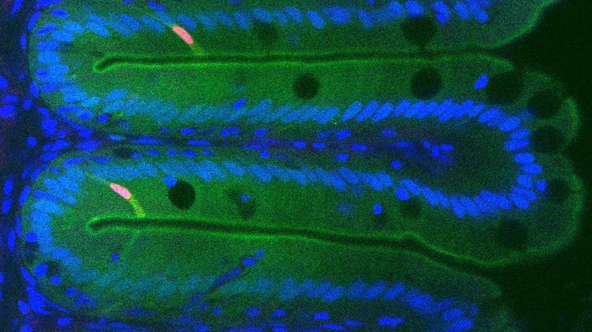 Fluorescence imaging of the zebrafish intestine reveals activity of ancient genetic regulatory elements. Nuclei of epithelial cells lining the intestine are shown in blue, and cells that have activated a regulatory element from the HES1 gene are shown in green.